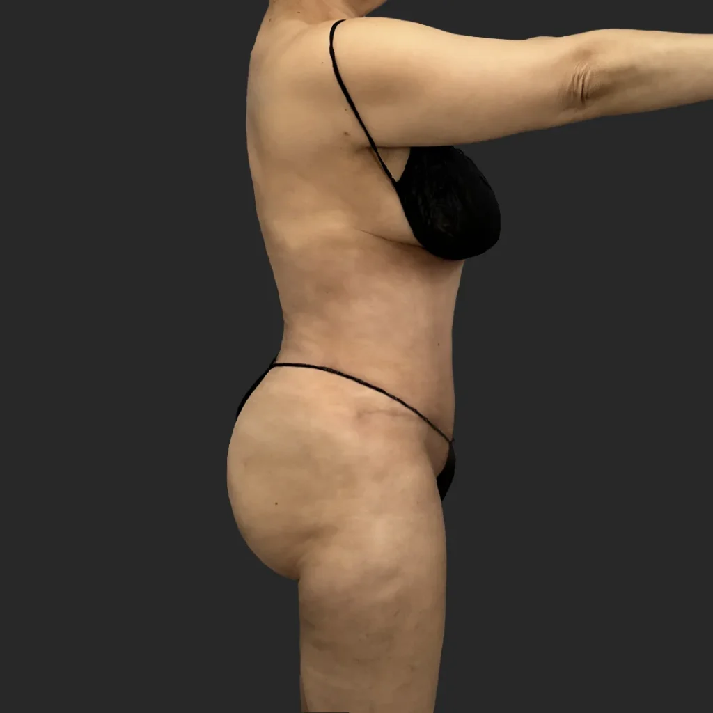 Additional after image