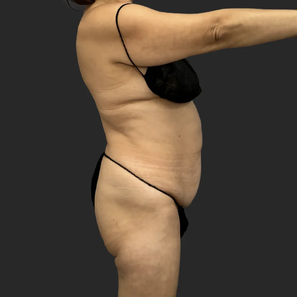 Additional before image