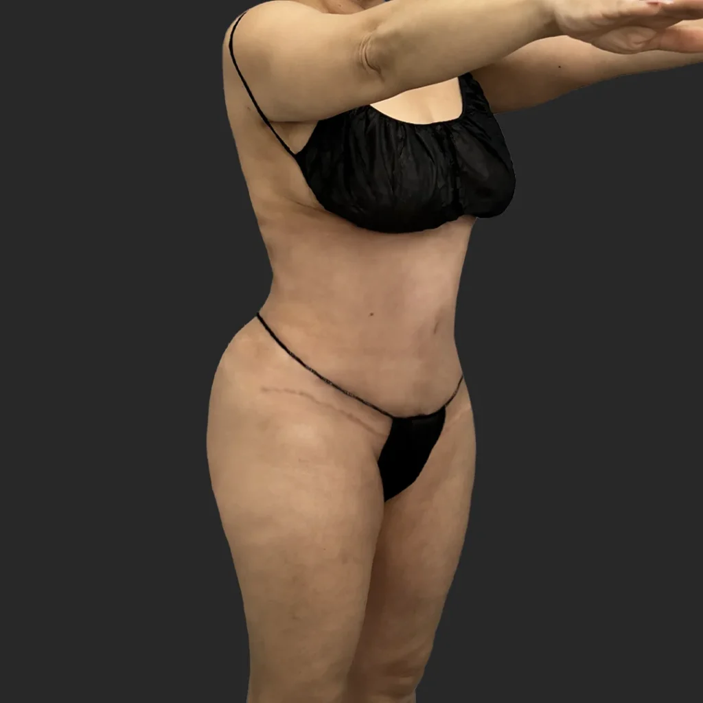 Additional after image