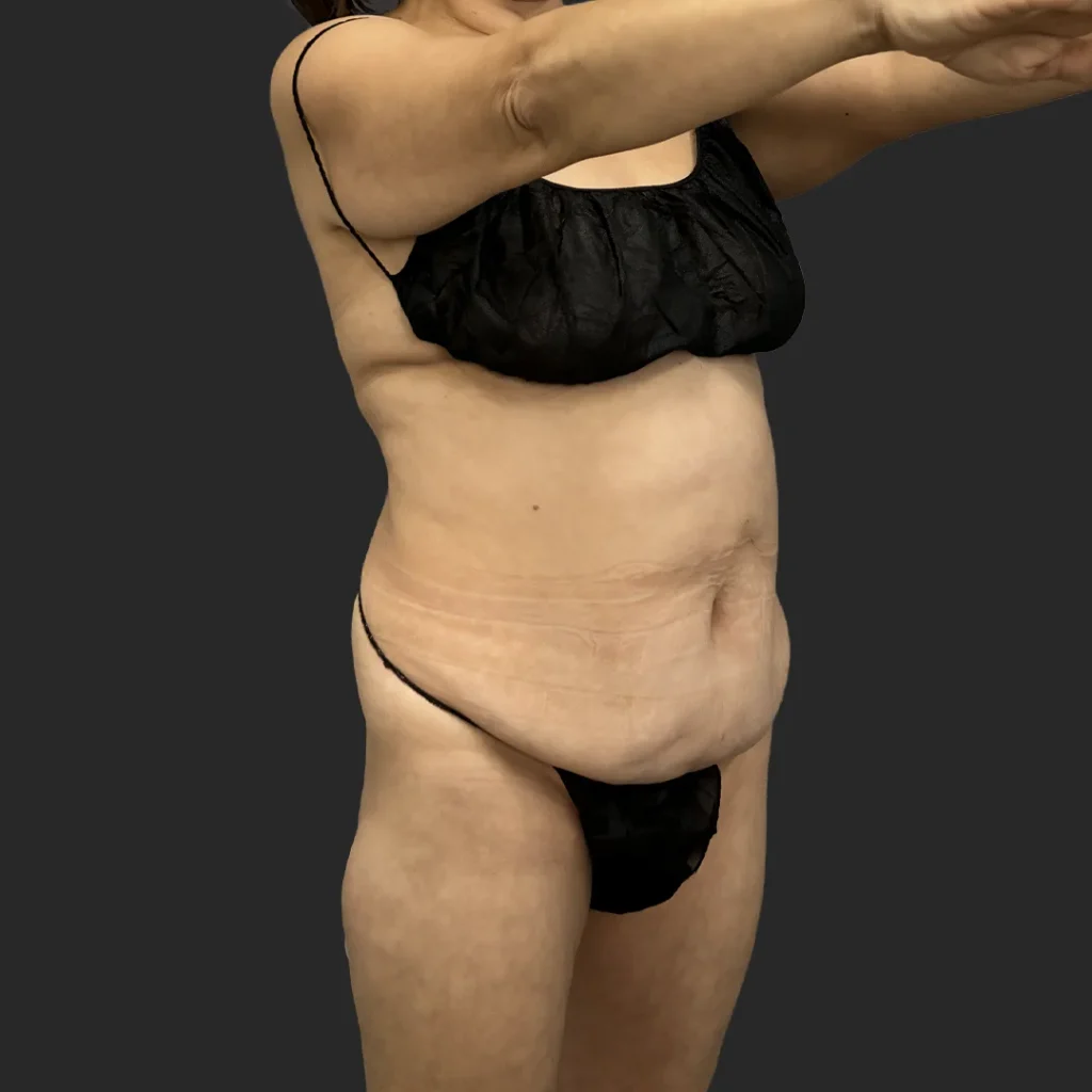 Additional before image